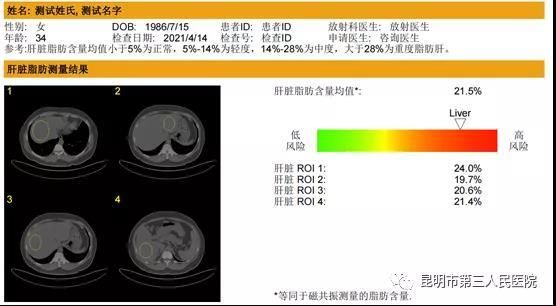 测定|搭载QCT软件的CT来了，看看能做什么？