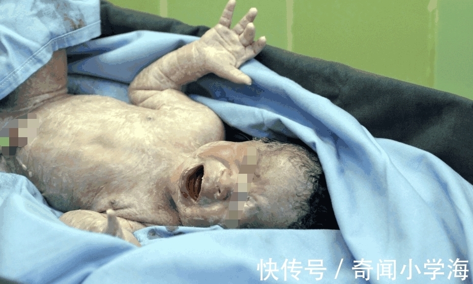 妇产科医生|女子怀孕五个月, 天天打游戏, 孩子出生后, 丈夫双腿哆嗦