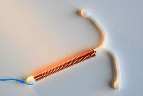 怀孕|新生宝宝“顺手牵环”,手握避孕环霸气出生,网友:此娃必成大器