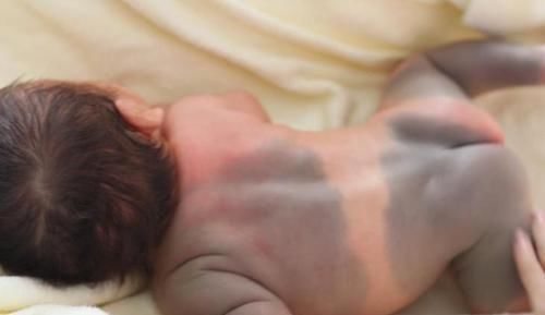 胎儿|胎记是怎么来的产科医生孕期远离3种行为,避免胎儿长记号