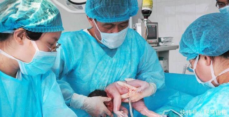 产科男医生|男医生接生怕被看隐私以下优势,是否能不再让产妇感到“羞涩”