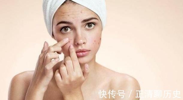痘痘|子宫好不好看脸，若脸上没有以下5种“信号”恭喜，子宫很健康