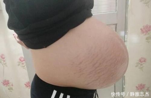 腹直肌|5张图领略有点夸张的悬浮肚,除了不好入盆,还有两种尴尬等着呢