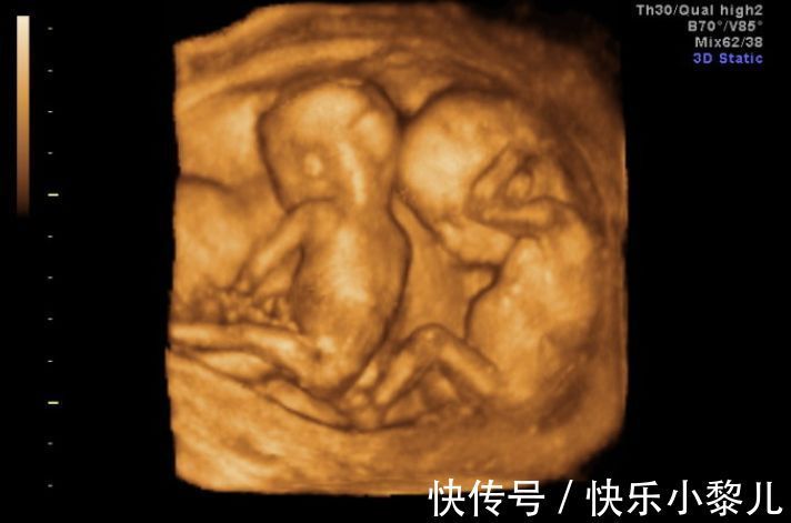 怀孕|准妈妈显怀太早可能存在危险,了解原因后,保证自己安全地显怀