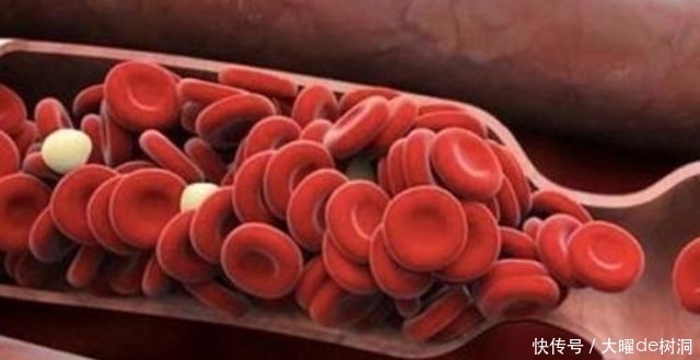 男人长时间滴酒不沾,身体会有什么变化?专家给出的答案只有这个