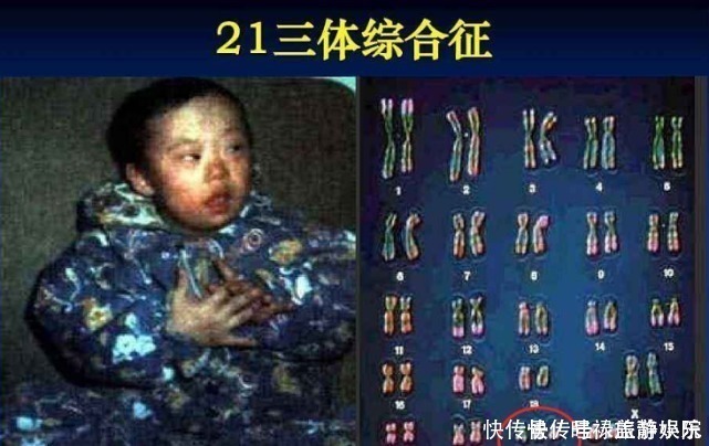 b超|孕期产检不想生个“傻孩子”,这三项产检必须按时做,不能忽视