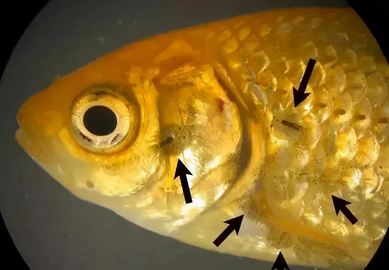 小白点|因大人做饭不讲究,1岁男童体内查出多种寄生虫,很多家庭中招