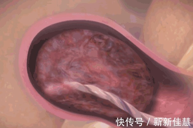 开十指|顺产到底有多疼3张图让你一目了然,妈妈太不容易,请善待她们