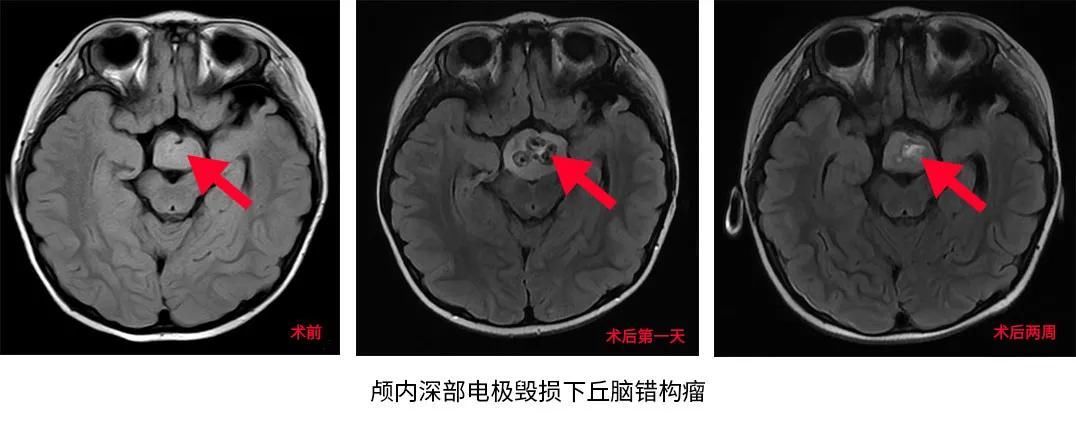 微笑|3岁女童性格好爱笑，但她的“微笑”却让父母操碎了心