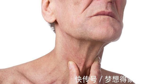 甲状腺结节|患有甲状腺结节的人,大多与3大原因有关,少吃2物,或可有效缓解