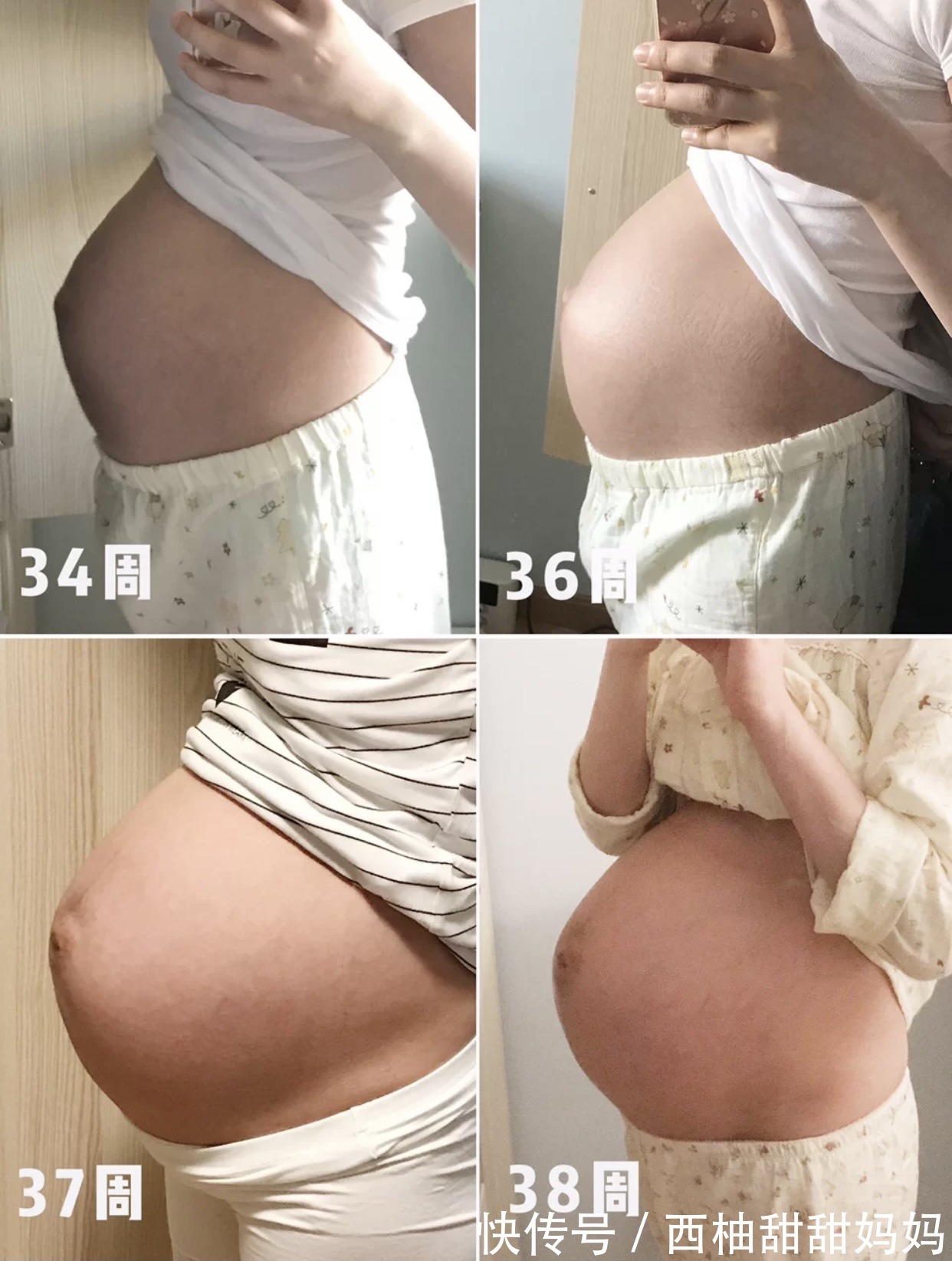 yi院|小心!孕期这三件事,切不可忽视