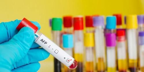 超声检查|肝功能正常不代表肝脏正常,也可能患癌,这“3项”检查要注意