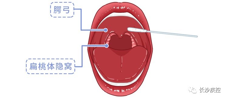 口咽拭子|核酸检测为什么要采口鼻，不能采耳？疾控专家告诉你原因