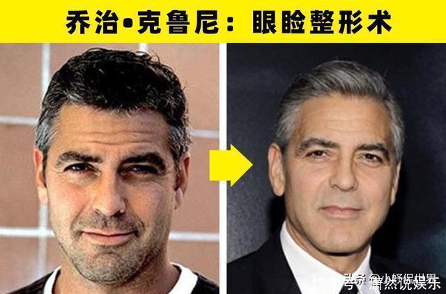 整容手术|大方承认自己做过整形手术的8名好莱坞明星