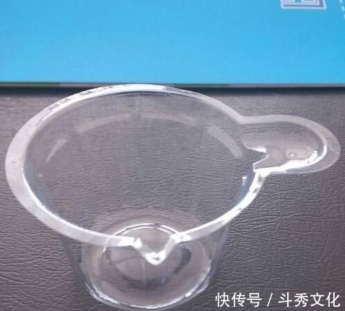 医院都要查血常规、便常规、尿常规,都能查出什么问题?