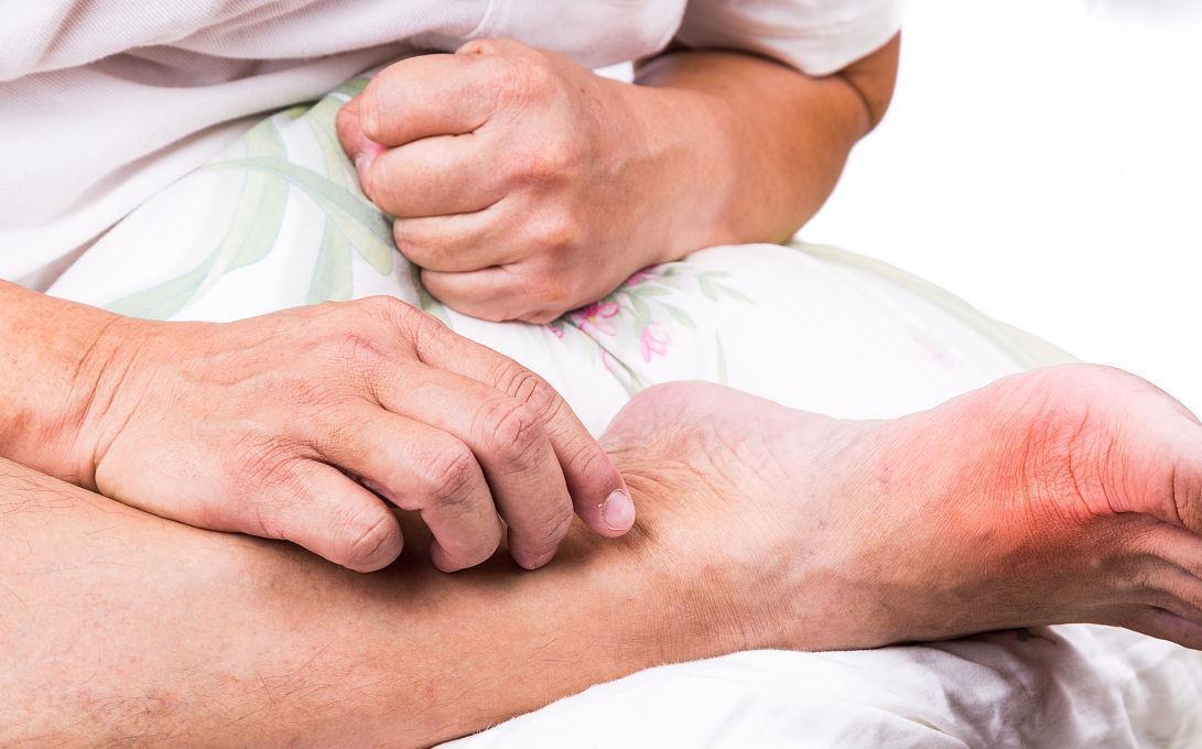 尿酸|难怪尿酸高居不下,有“1物”比猪肉嘌呤高42倍,很多人仍然在吃