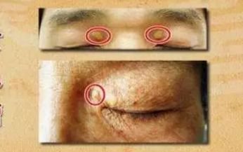 面相|注意!这几种面相可能预示着心脏疾病,很多人都忽视了…