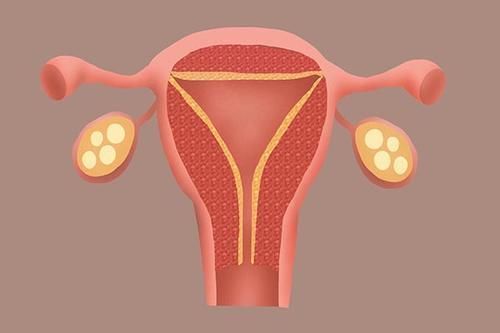 息肉|体检查出的结节、增生和息肉，哪些会癌变，哪些不要治？
