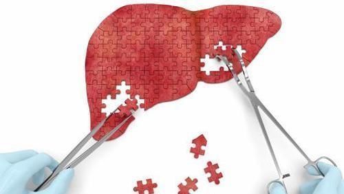 蒿坪毛尖|有肝病的人,若是睡觉时出现这5种表现,那恭喜你,肝病正在好转