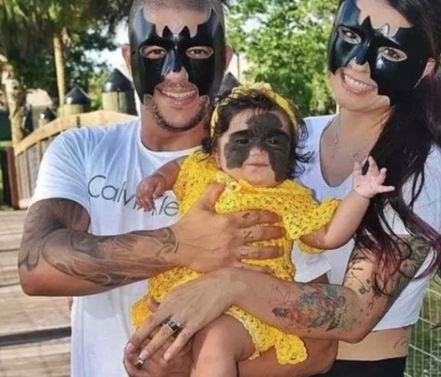 父母|女孩出生就带有“蝙蝠胎记”,做过7次整形手术,现在怎么样了