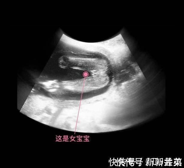 羊水|胎儿从卵泡到性别形成,17张图片清晰诠释,男宝女宝看得很清楚
