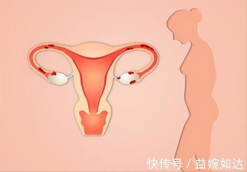 胞脉|宫寒百病生，2个调理动作，坚持每天做可以暖子宫，子宫暖气色好