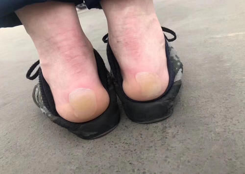 路边摊|给孩子买鞋子可要慎重,这些“毒童鞋”已被央视点名,可别再买了
