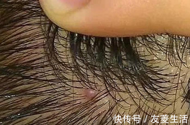 洗头|早上刚刚洗的头发怎么又油了？到底是怎么回事？