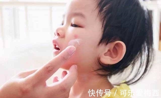 宝宝|被蚊子“选中”的宝宝,是因为甜度高吗?蚊子的口味其实是这样的