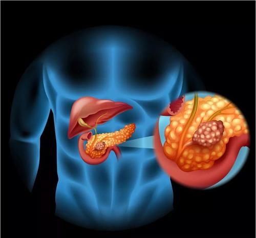 治愈|这7个病无法治愈，排在首位的死亡率100%，不能存半分侥幸心理！