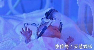 济南第二医院|32岁孕妇舍命生五胞胎,最小的仅鸡蛋一般大,令人揪心的纪录片!