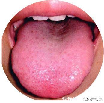 中药|小儿脾胃虚弱怎么办该如何消除家长这块心病,严大夫这里有话说