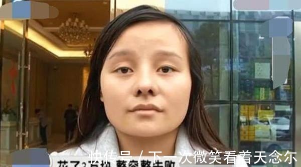 隆鼻|女子隆鼻手术成功, 却遭到嘲笑 你的五官配不上这么完美的鼻子