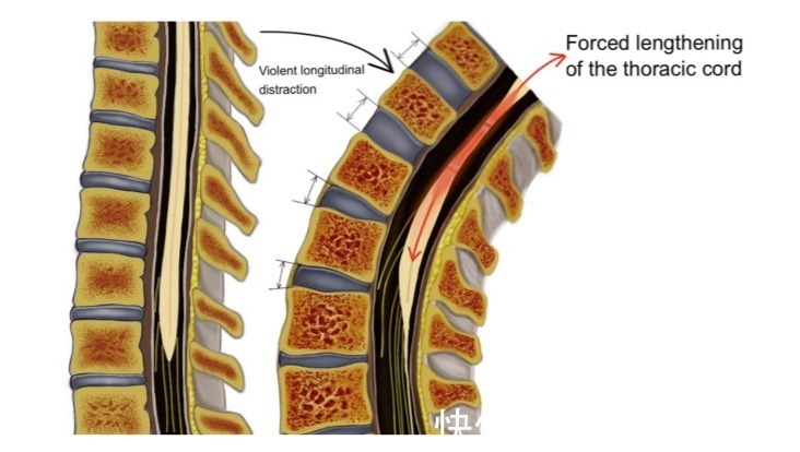 舞蹈|医生的孩子,为啥都不去学舞蹈?这可能是孩子圈的潜规则