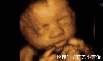 胎宝|22周四维彩超第一次见胎宝,被丑哭,这些原因导致胎儿看起来丑