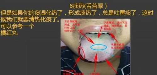 齿痕|齿痕重是脾虚，舌苔厚也是脾虚吗？怎样把舌苔变薄、齿痕消失呢？