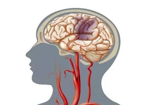 脑供血不足会有什么危害？4种迹象若出现，别再不当回事！