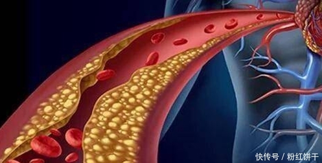 张老太|79岁老人,热水泡脚住医院,养生名医建议:泡脚有风险,需谨慎
