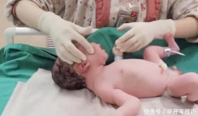 生娃|宝宝出生后被带走十几分钟,这段时间经历了什么组图带你看真相!