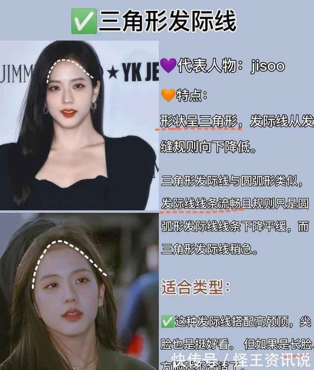 发际线 几种常见的发际线,你又是哪一种呢几分钟教你植发如何选发际线!