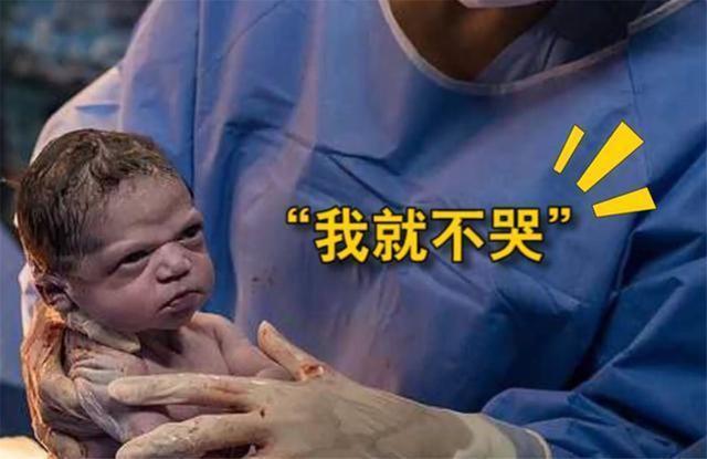 小宝宝|巴西小宝宝一出生就“怒瞪”医生，一副臭脸表情，网友：被萌翻了