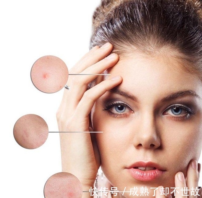 黑头|皮肤差怎么办?学会这几种方法,让肌肤越来越好