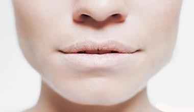 脸色苍白|寿命短的人,可能身上有4处发白,若占1个不占,恭喜容易长寿