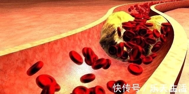 记忆力|每天早上吃一个“鸡蛋”,一个月后,身体可能会有3个变化!