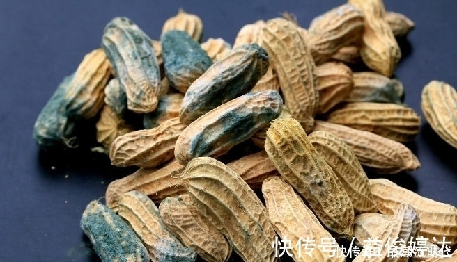 腌制品|4种食物堪称“烂肝王”，40岁过后最好不要吃，肝越吃越坏