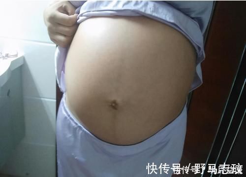 黑线|为什么孕妈肚子上有黑线?和这三个因素有关,孕妈要了解