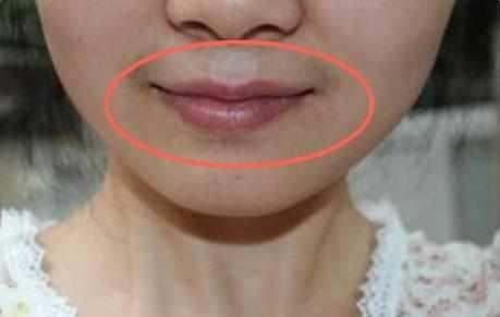 妇科|女性若有妇科炎症,脸上可能会有3个“标记”!希望你1个也没