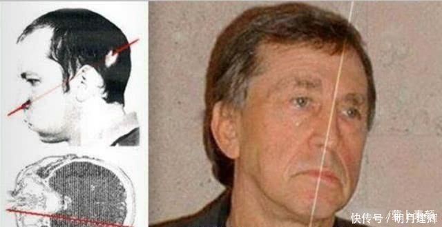 粒子 当他把头伸进粒子加速器时,他被高能质子束直接击中