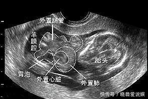 性别|医生是如何判断胎儿性别的？下列情况医生会主动告知胎儿性别