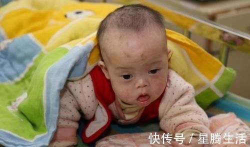 婴儿|9个月婴儿紧握拳头,奶奶发现有问题带去医院检查,医生:来晚了